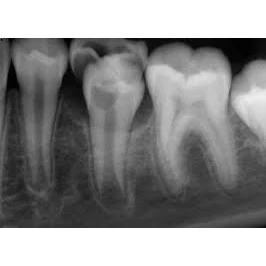 XRAYS/INITIAL SERVICES