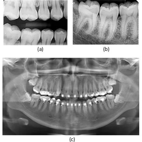 XRAYS/INITIAL SERVICES