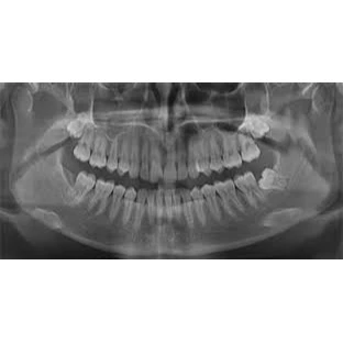 XRAYS/INITIAL SERVICES