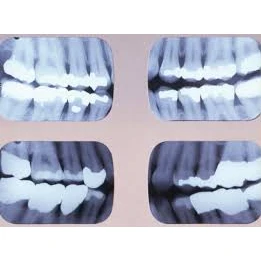 XRAYS/INITIAL SERVICES
