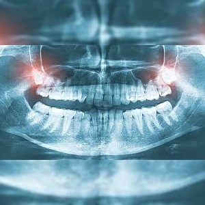 XRAYS/INITIAL SERVICES