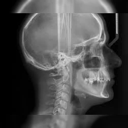 XRAYS/INITIAL SERVICES