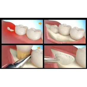 SURGERY
