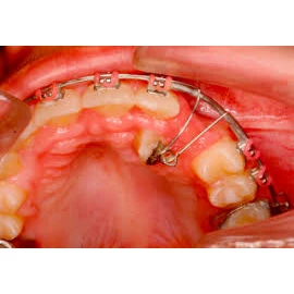 SURGERY