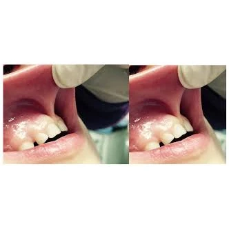 SURGERY