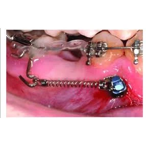 SURGERY