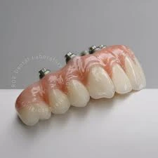 IMPLANTS
