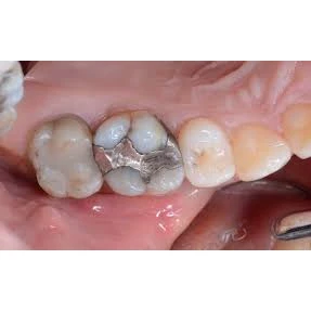CONSERVATIVE AND ENDODONTIC TREATMENT