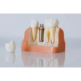 CONSERVATIVE AND ENDODONTIC TREATMENT