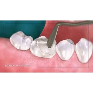 CONSERVATIVE AND ENDODONTIC TREATMENT