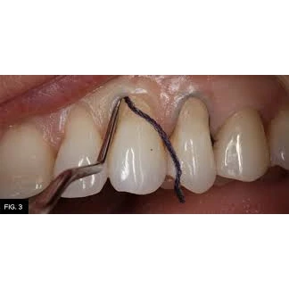 CONSERVATIVE AND ENDODONTIC TREATMENT