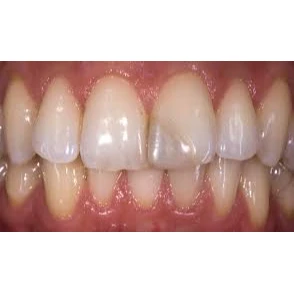 CONSERVATIVE AND ENDODONTIC TREATMENT
