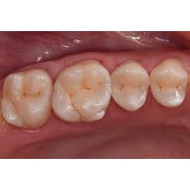 CONSERVATIVE AND ENDODONTIC TREATMENT