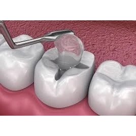 CONSERVATIVE AND ENDODONTIC TREATMENT