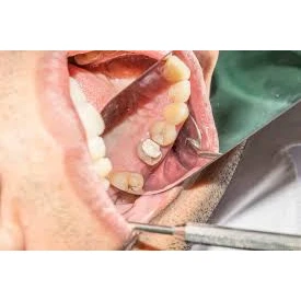 CONSERVATIVE AND ENDODONTIC TREATMENT