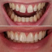 CONSERVATIVE AND ENDODONTIC TREATMENT