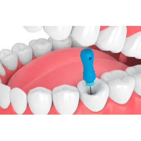 CONSERVATIVE AND ENDODONTIC TREATMENT