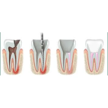 CONSERVATIVE AND ENDODONTIC TREATMENT