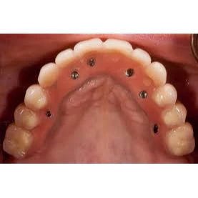 CONSERVATIVE AND ENDODONTIC TREATMENT
