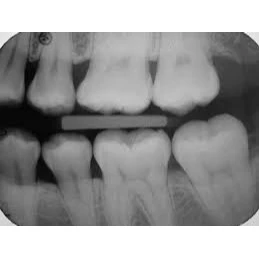 CONSERVATIVE AND ENDODONTIC TREATMENT