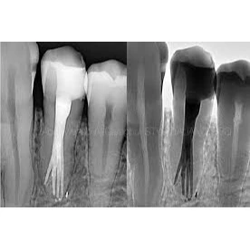 CONSERVATIVE AND ENDODONTIC TREATMENT