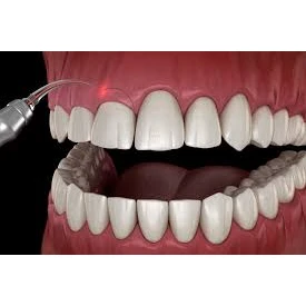PERIODONTIC