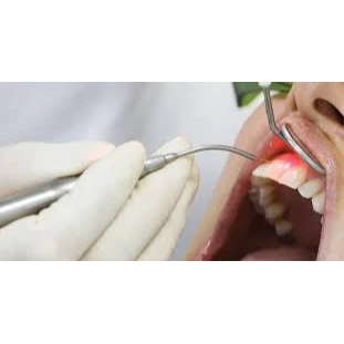 PERIODONTIC