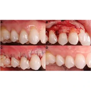 PERIODONTIC