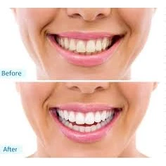 PERIODONTIC