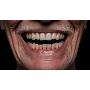 PERIODONTIC