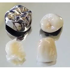PROSTHODONTICS