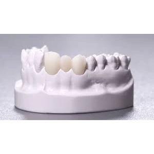 PROSTHODONTICS