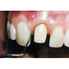 PROSTHODONTICS
