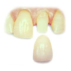 PROSTHODONTICS