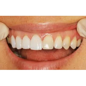PROSTHODONTICS