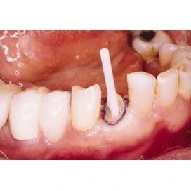 PROSTHODONTICS