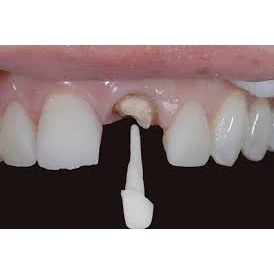 PROSTHODONTICS