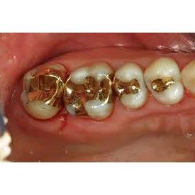 PROSTHODONTICS