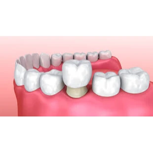 PROSTHODONTICS