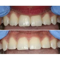 PROSTHODONTICS