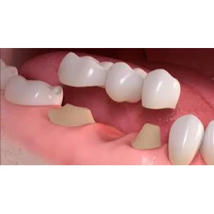 PROSTHODONTICS