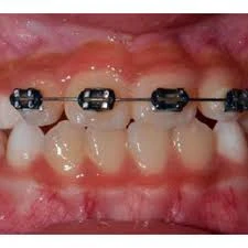 ORTHODONTICS