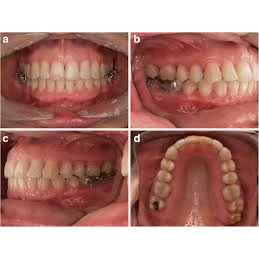 ORTHODONTICS