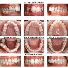 ORTHODONTICS