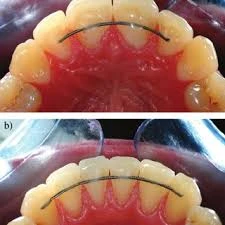 ORTHODONTICS