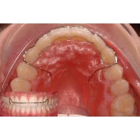 ORTHODONTICS